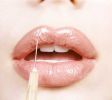 Donne: I ritocchini al Sud Costano Meno 1