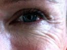 Rughe sul Viso: Il Dramma delle Donne 0