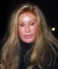 Jocelyn Wildenstein: Mostro di Bellezza 1