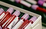 Scienza: Realizzato il Sangue Sintetico 1