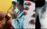 Un Cocktail di Farmaci contro i Melanomi 2